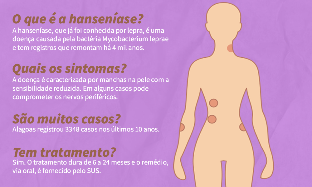 Hanseníase (lepra): o que é, sintomas e tratamento