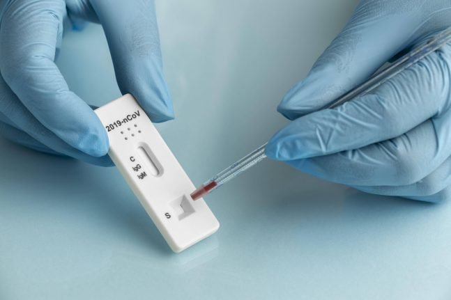teste covid alagoas agencia tatu - Em AL, menos de 10% dos testes de Covid-19 em outubro deram positivo